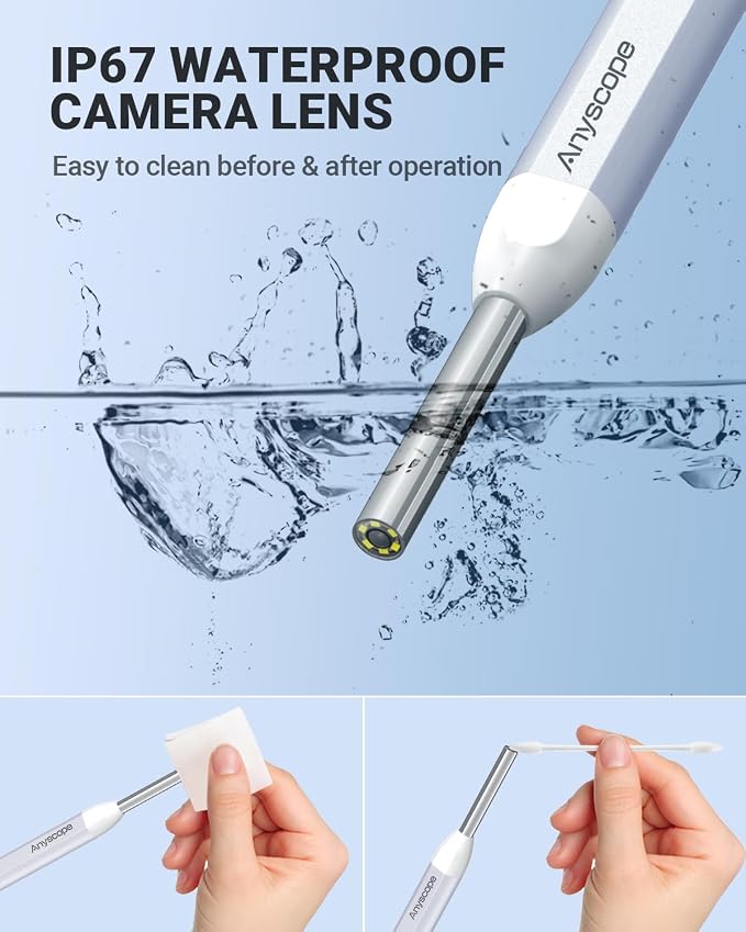 Digital Otoscope with Gyroscope, HD Ear Camera with Ear Wax Removal Tools, Video Ear Scope Otoscope with Light, Compatible with iPhone and Android (White)