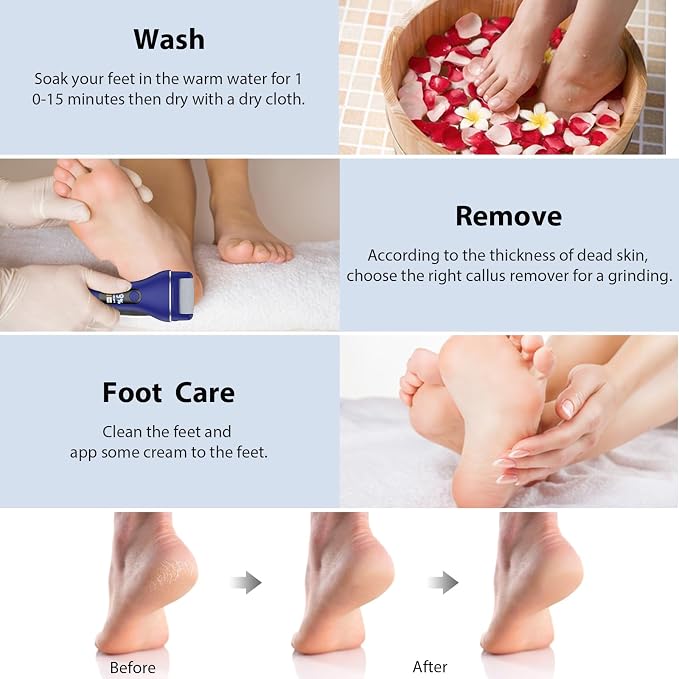 AdamPark Electric Callus Remover for Feet, Rechargeable Portable Electronic Foot Callus Remover 2-in-1 Wet/Dry Foot Scrubber Electric Toot File for Hard Cracked Dry Dead Skin(Blue)