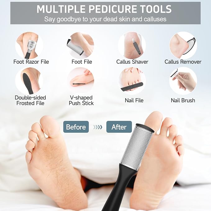 AdamPark Electric Foot File Callus Remover, Rechargeable Pedicure Tools Foot Care Kit, Portable Callus Remover Kit with 3 Roller Heads,2 Speed,Battery Display (Black KW)
