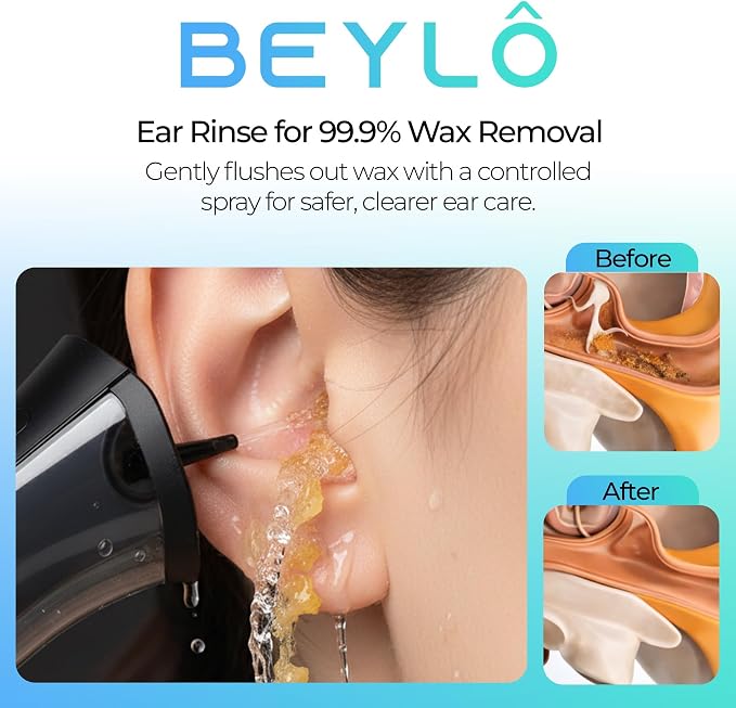 Ear Wax Removal Kit – Ear Cleaner for Adults and Kids – Dual Tank Design, 4 Nozzles, 4 Cleaning Modes, IPX6 Waterproof, One-Hand Operation – USB-C Rechargeable Electric Earwax Irrigation Device