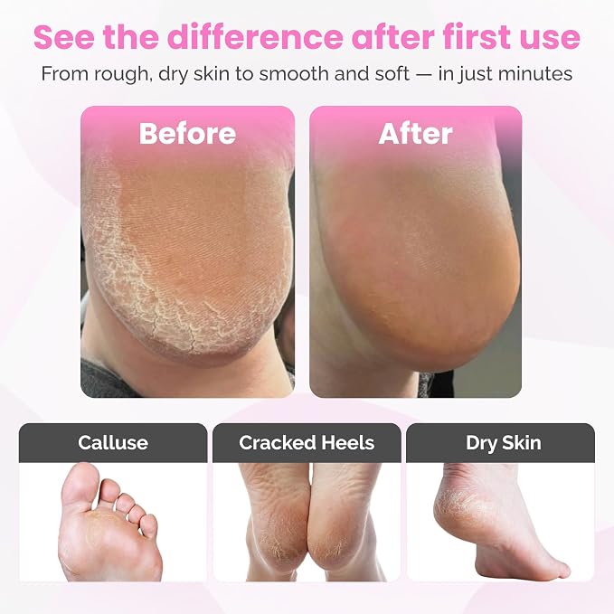 Electric Foot Callus Remover Tool – Aluminum Body Foot Grinder with 60 Sanding Discs, Adjustable Speed Control, Corded Design, 800 RPM Electric Foot File for Exfoliation & Smooth Finish