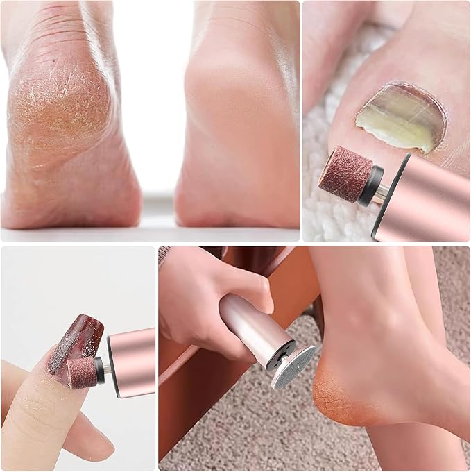 Rechargeable Electric Foot Callus Remover, Pedicure Tools for Feet, Electric Foot File, Heel Scraper for Cracked Heels, Calloused Feet Remover Tool (Pink)