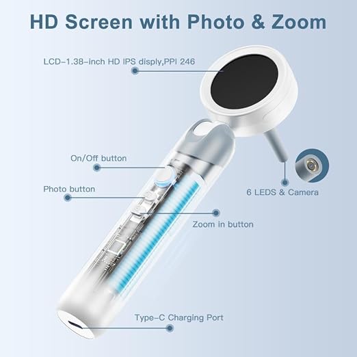 Otoscope Ear Camera with Light, 1.4” Screen 1080P HD Ear Scope, 12 Silicone Specula Tips, Photo & Video Recording, Type-C Rechargeable, Ear Otoscope Camera for Adult Kid and Pet