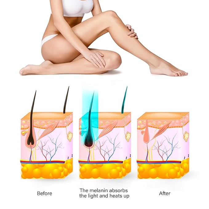 Boston & Co. Sapphire Cooling IPL Hair Removal Device Painless Long-Lasting Result for Women & Men, Permanent Hair Reduction 3 Precision Heads for Face, Bikini, Legs, or Full Body Use