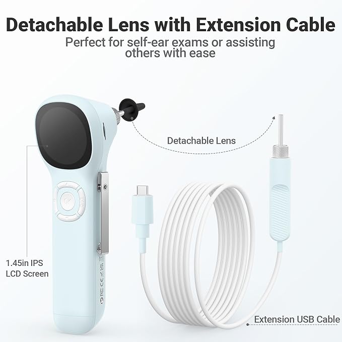 ScopeAround Digital Otoscope w/IPS Screen, 720p HD Smart Video Otoscope with Light, Ear Scope Otoscope with Camera Ear Wax Removal Camera, Ear Checker, Power On and Go (Blue)