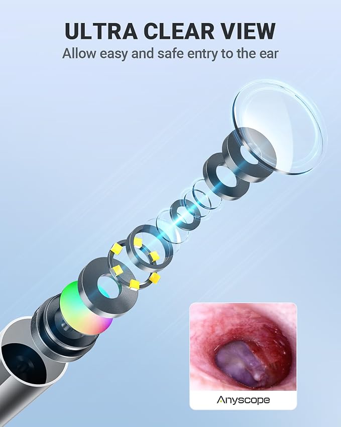 Wireless Otoscope with Gyroscope, Ear Camera with Dual View, 3.9 mm Otoscope with Light, Ear Scope with Ear Wax Removal Tool for Kids, Adults, and Pets, Compatible with iPhone and Android