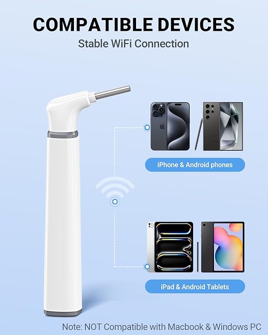 ScopeAround Otoscope with Light, Otoscope Camera w/Dual View, 720pHD WiFi Ear Scope w/ 6 LED Lights, Ear Camera 3.9mm Lens for Kids & Adults, Ear Scope Compatible w/Android & iPhone