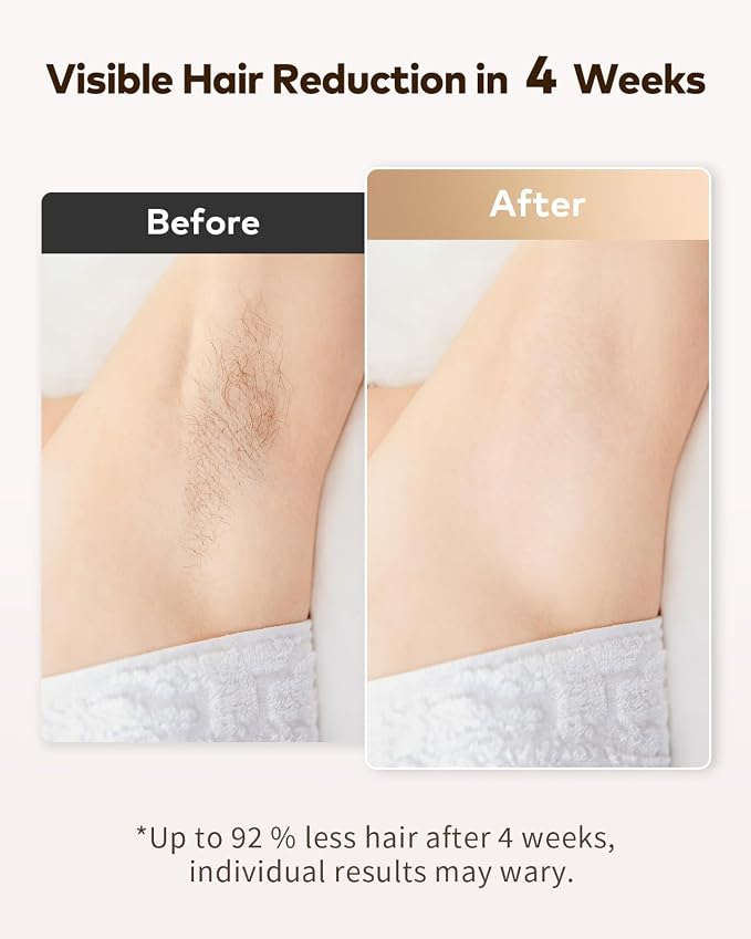 LYSMOSKI Laser Hair Removal for Women and Men, Safe at-Home Hair Removal Device, Hair Laser Removal with Long-Lasting in Hair Reduction for Armpits Back Legs Arms Face Bikini Line