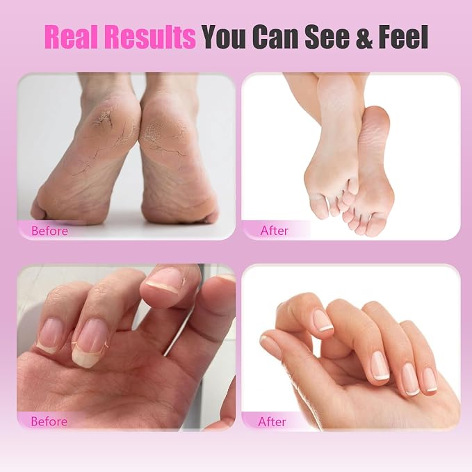 Electric Foot Callus Remover, 2-in-1 Rechargeable Pedicure Tool with Adjustable Speed, LED Display, Sanding Discs & Nail Drill Bits, Professional Electric Foot File for Smooth Soft Feet