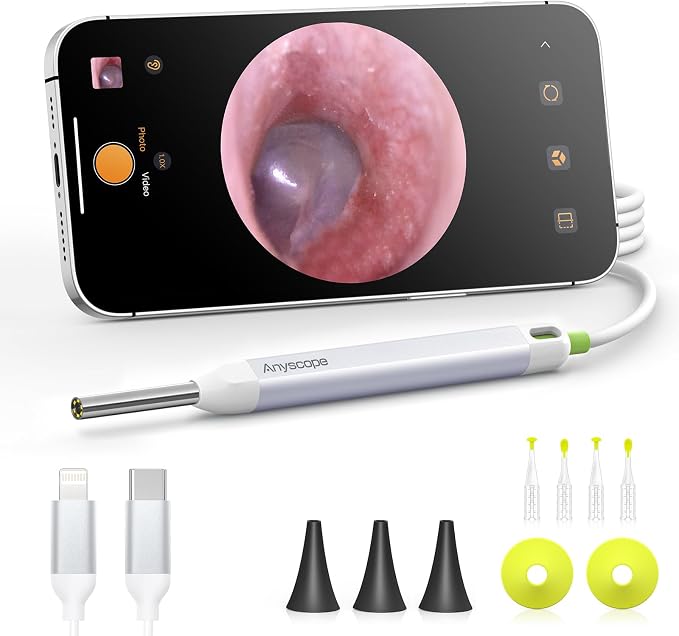 Digital Otoscope with Gyroscope, HD Ear Camera with Ear Wax Removal Tools, Video Ear Scope Otoscope with Light, Compatible with iPhone and Android (White)