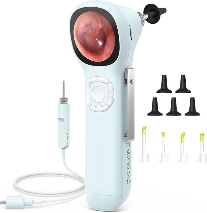 ScopeAround Digital Otoscope w/IPS Screen, 720p HD Smart Video Otoscope with Light, Ear Scope Otoscope with Camera Ear Wax Removal Camera, Ear Checker, Power On and Go (Blue)