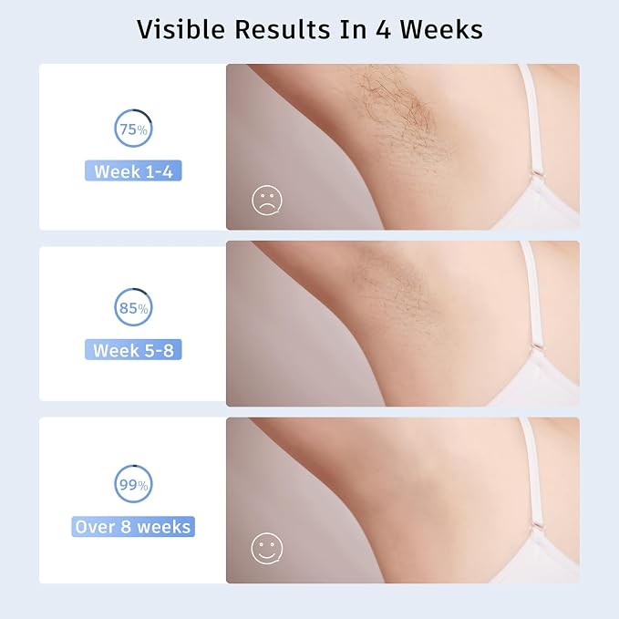 Finequin Laser Hair Removal,Laser Hair Removal for Women, Hand-held Hair Removal Device, IPL Hair Removal For Facial Legs Arms Whole Body Use (Rose)