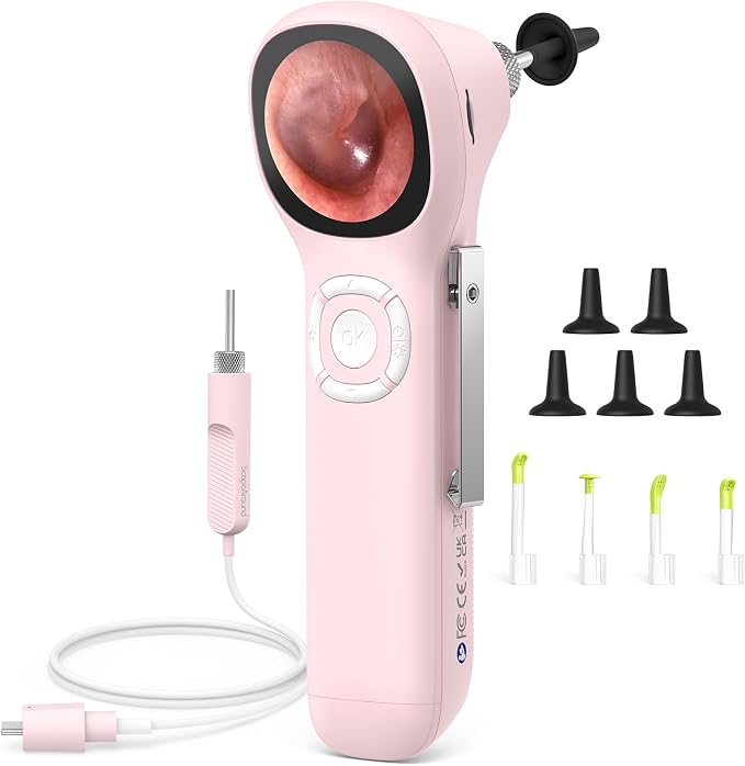 ScopeAround Digital Otoscope w/IPS Screen, 720p HD Smart Video Otoscope with Light, Ear Scope Otoscope with Camera Ear Wax Removal Camera, Ear Checker, Power On and Go, Pink