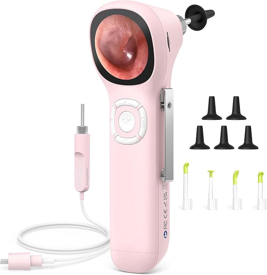 ScopeAround Digital Otoscope w/IPS Screen, 720p HD Smart Video Otoscope with Light, Ear Scope Otoscope with Camera Ear Wax Removal Camera, Ear Checker, Power On and Go, Pink