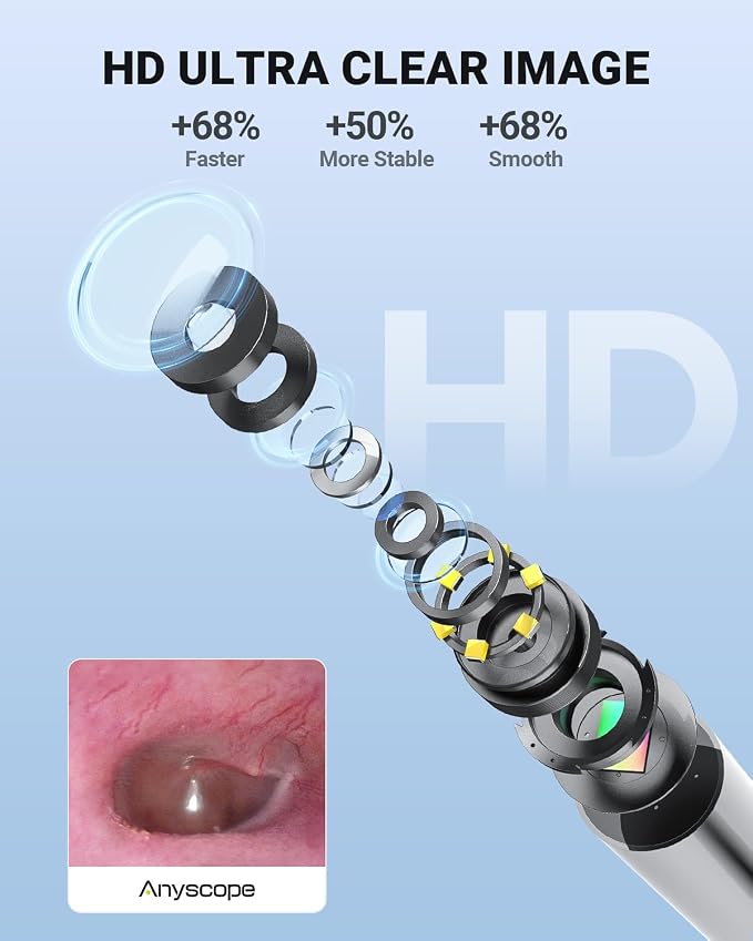 Wireless Otoscope with Gyroscope, Ear Camera with Dual View, 3.9 mm Otoscope with Light, Ear Scope with Ear Wax Removal Tool, Ear Cleaning Kit, Compatible with iPhone and Android