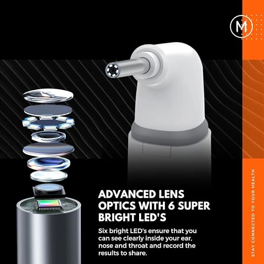 MOBI Smart Otoscope for Ears, Nose & Throat, 1080P HD Ear Camera with App for Adults & Kids, Rechargeable Digital Otoscope with 6 LED Lights, Multi-Axis Gyroscope & 3 Speculum Tips