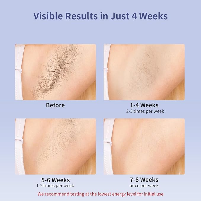 MLAY IPL Laser Hair Removal, Hair Removal Device with Ice Cooling Painless Hair Removal for Women & Men, Permanent Hair Removal at Home for Arms Armpits Face Legs Bikini Line, 5 Energy Levels, 2 Heads