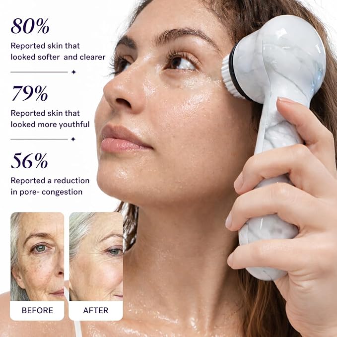 Michael Todd Beauty Soniclear Allure 2026 Readers Choice Winner Sonic (no Rotating) Facial Cleansing + Exfoliation Brush for Men/Women, Antimicrobial Protected Bristles, 4 speeds, Serum Infusion Head