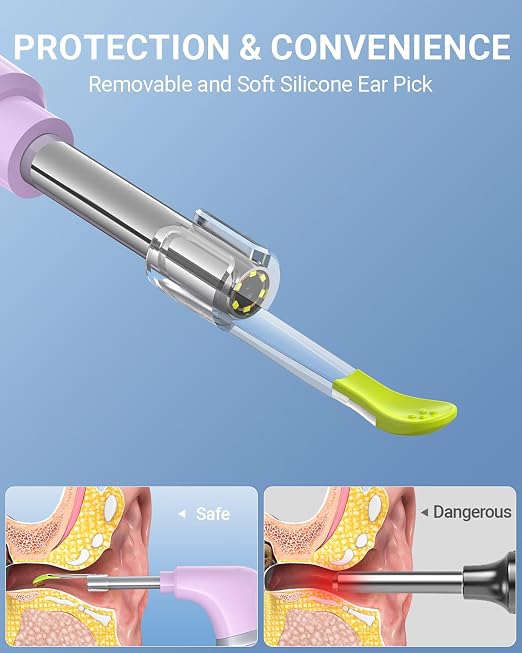 ScopeAround Otoscope with Light, Ear Camera with Dual View, 720pHD WiFi Ear Scope with 6 LED Lights, 3.9mm Lens Otoscope Camera for Kids and Adults, Ear Scope Compatible w/iPhone and Android Pink