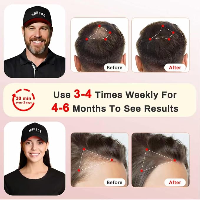 Red Light Hair Growth Cap, 528 Total Light Emitters, Red Light Therapy for Hair,Adjustable Fit,At-Home Sessions for Men & Women, Irradiation Aesthetic