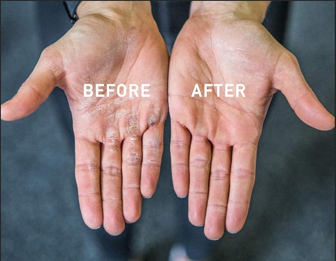 Callus Rx Callus Removal Tool | Eliminates Hard Palm Skin | No Pumice Stone or Gloves | Removes Calluses in Seconds | Best Hand Callus Remover for Workouts, WODs, Weightlifting