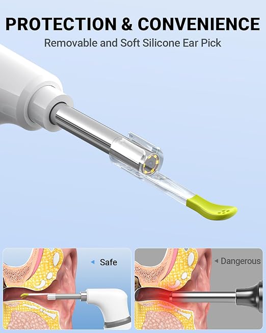 ScopeAround Otoscope with Light, Otoscope Camera w/Dual View, 720pHD WiFi Ear Scope w/ 6 LED Lights, Ear Camera 3.9mm Lens for Kids & Adults, Ear Scope Compatible w/Android & iPhone