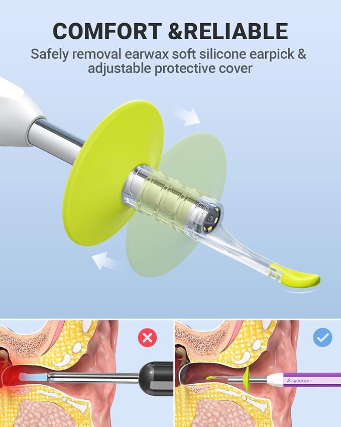 Digital Otoscope with Gyroscope, HD Ear Camera with Ear Wax Removal Tools, Video Ear Scope Otoscope with Light, Compatible with iPhone and Android (Purple)