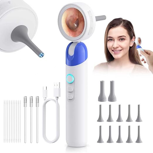 1080P HD Otoscope Ear Camera for Family, Medical Grade 1.38" Screen, Telemedicine Ready, 12 Silicone Tips, Photo/Video, Type-C Charging, Home Medical（Blue）