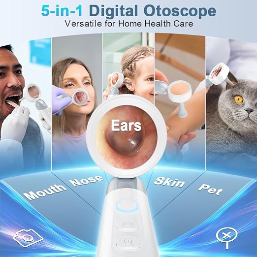 Otoscope Ear Camera with Light, 1.4” Screen 1080P HD Ear Scope, 12 Silicone Specula Tips, Photo & Video Recording, Type-C Rechargeable, Ear Otoscope Camera for Adult Kid and Pet
