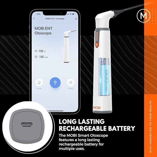 MOBI Smart Otoscope for Ears, Nose & Throat, 1080P HD Ear Camera with App for Adults & Kids, Rechargeable Digital Otoscope with 6 LED Lights, Multi-Axis Gyroscope & 3 Speculum Tips