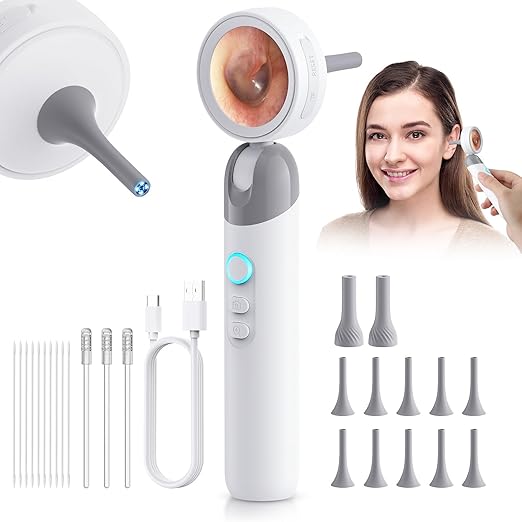 1080P HD Otoscope Ear Camera for Family, Medical Grade 1.38" Screen, Telemedicine Ready, 12 Silicone Tips and 3 Adhesive Ear Sticks, Photo/Video, Type-C Charging, Home Medical | 1.38" Screen for real-time viewing. Capture photos and videos, Connect to ...