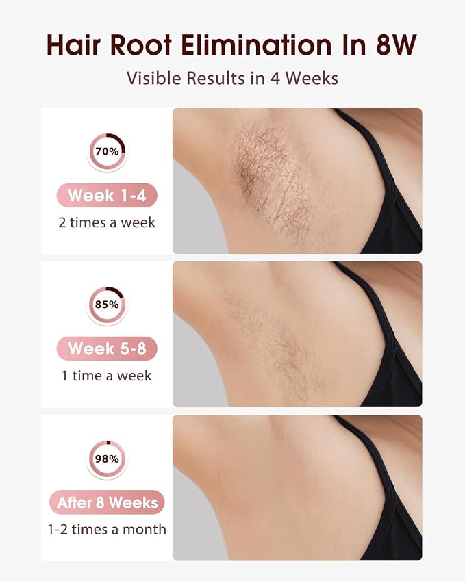 LYSMOSKI Laser Hair Removal, IPL Hair Removal with Ice-Cooling System for Painless & Long-Lasting Result, Safe At-Home Hair Remover Device for Armpits Back Legs Arms Face Bikini Line, Rose Gold