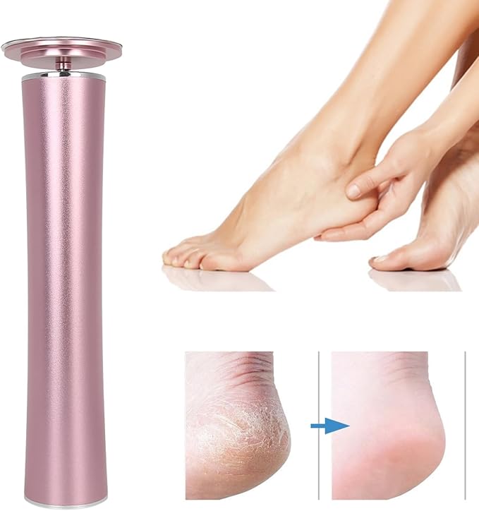 MAVIS LAVEN Automatic Callus Remover Foot File Pedicure Tool with Replaceable Grinding Discs for Healthier Feet
