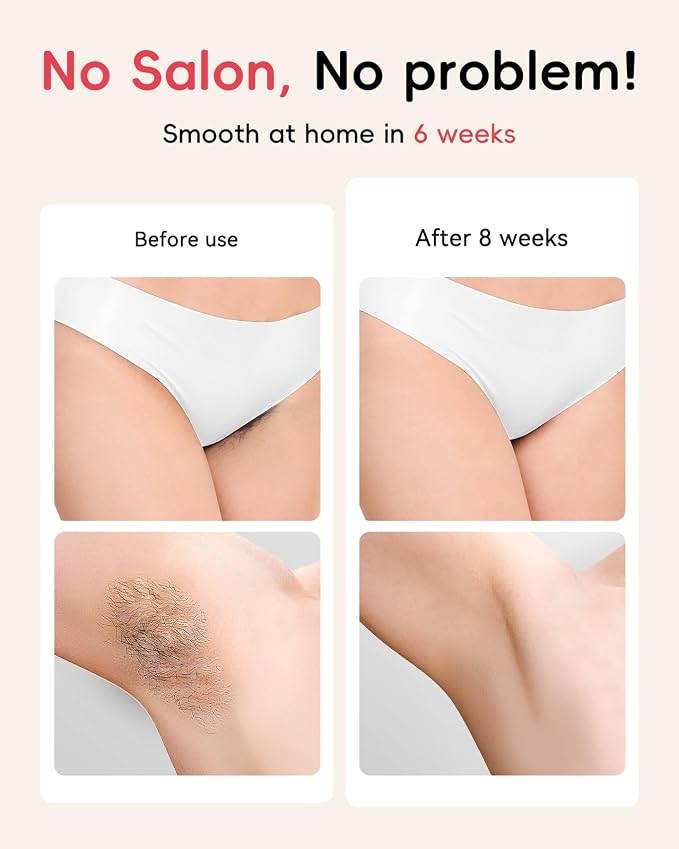 IPL Hair Removal, Laser Hair Removal for Women and Men, Safe at-Home Epilator Hair Removal Device for Armpits Back Legs Arms Face Bikini Line