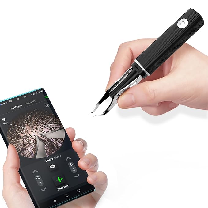 Hair Removal Tweezer with 1080p Camera, Ultimate Precision: Tweezer with Camera - Perfect for Delicate Tasks! - - Ear Hair Eyebrow Tweezer