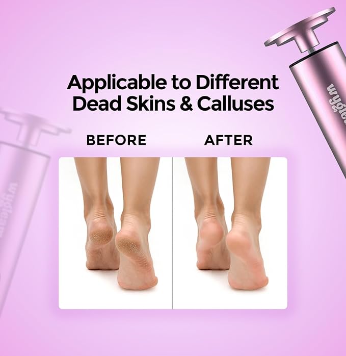 Electric Callus Remover for Feet & Nail File Drill Kit - 2 in 1 Rechargeable Pedicure Tools for Flawless Feet - Professional Foot File with 3 Speeds for Dead Skin Removal - At Home Pedicure