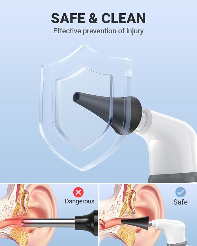 Wireless Otoscope with Gyroscope, Ear Camera with Dual View, 3.9 mm Otoscope with Light, Ear Scope with Ear Wax Removal Tool, Ear Cleaning Kit, Compatible with iPhone and Android