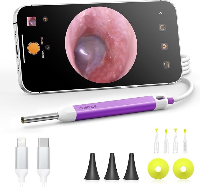 Digital Otoscope with Gyroscope, HD Ear Camera with Ear Wax Removal Tools, Video Ear Scope Otoscope with Light, Compatible with iPhone and Android (Purple)