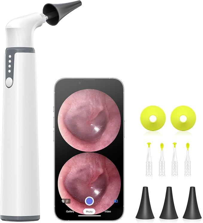 Wireless Otoscope with Gyroscope, Ear Camera with Dual View, 3.9 mm Otoscope with Light, Ear Scope with Ear Wax Removal Tool for Kids, Adults, and Pets, Compatible with iPhone and Android