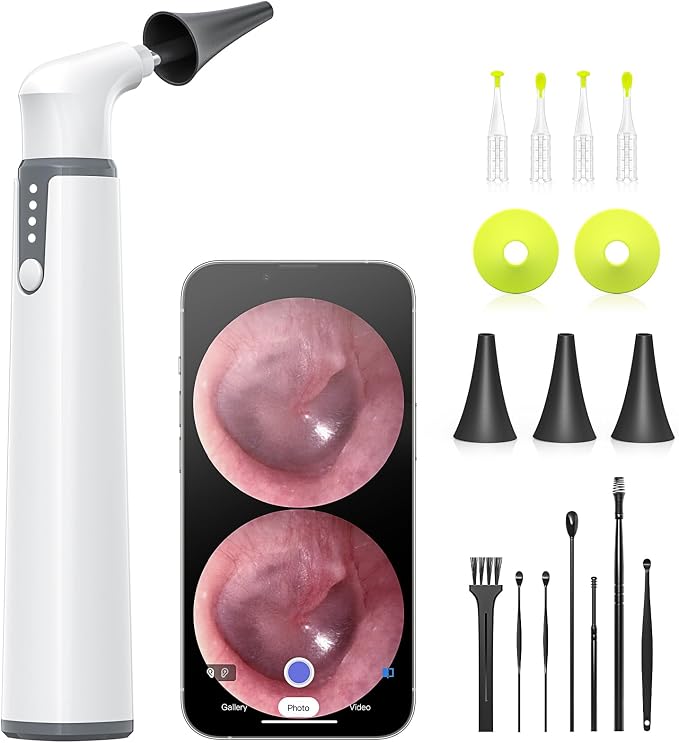 Wireless Otoscope with Gyroscope, Ear Camera with Dual View, 3.9 mm Otoscope with Light, Ear Scope with Ear Wax Removal Tool, Ear Cleaning Kit, Compatible with iPhone and Android