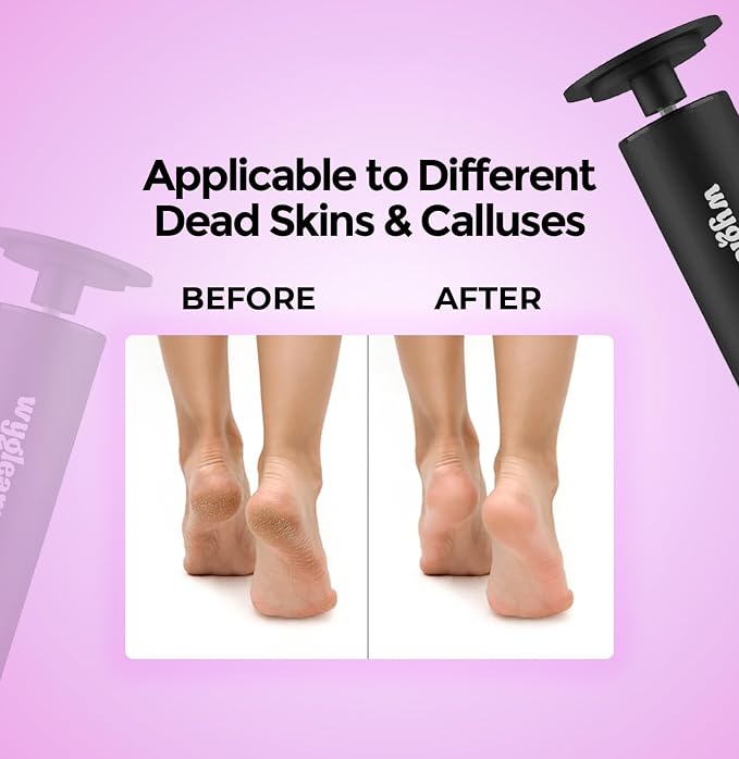 Electric Callus Remover for Feet & Nail File Drill Kit - 2 in 1 Rechargeable Pedicure Tools for Flawless Feet - Professional Foot File with 3 Speeds for Dead Skin Removal - At Home Pedicure