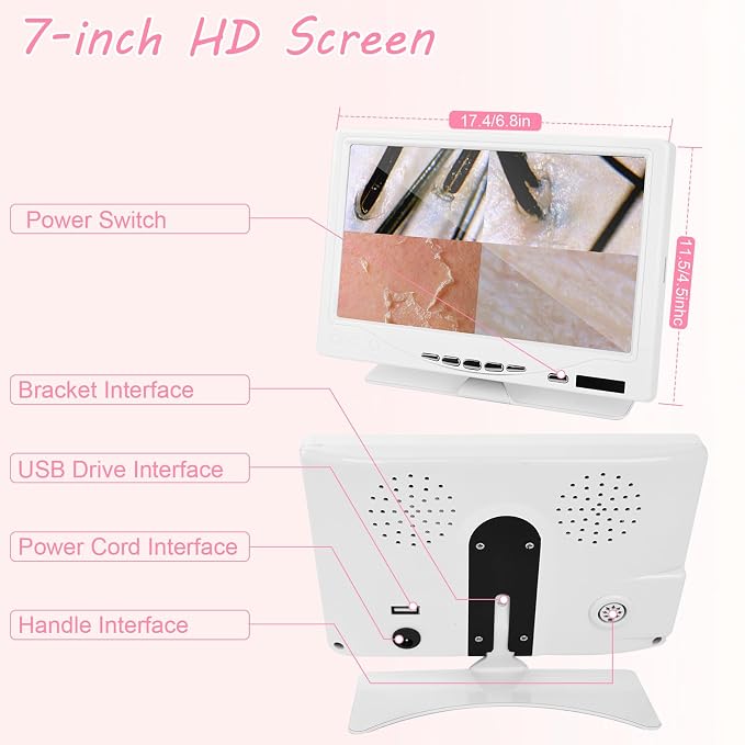 Beauty Star 7-Inch Scalp & Skin Analyzer with 50X/200X Dual Lenses, 4-Split View & 16GB Storage – HD Trichology Microscope Camera for Professional Salon, Head Spa, and Home Hair Follicle Health