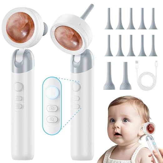 Otoscope Ear Camera with Light, 1.4” Screen 1080P HD Ear Scope, 12 Silicone Specula Tips, Photo & Video Recording, Type-C Rechargeable, Ear Otoscope Camera for Adult Kid and Pet