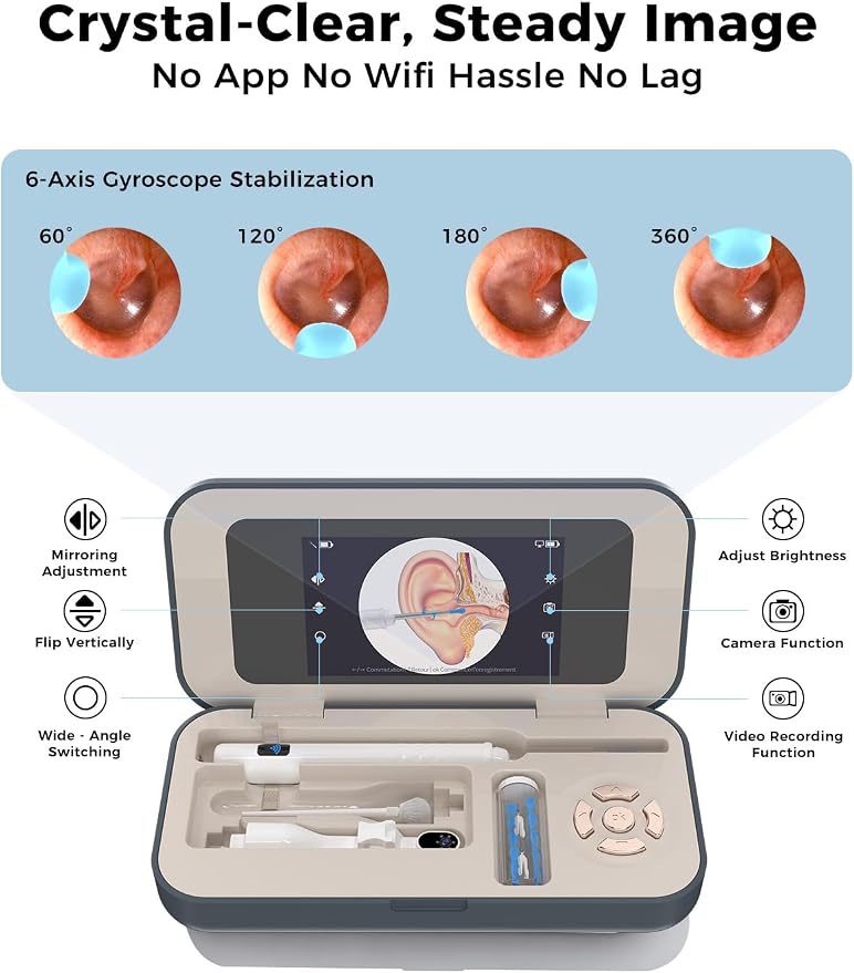 Sofbunny A03 Ear Wax Removal Tool Camera with Screen, Ear Cleaner with 1080P HD Camera, 3 in 1 Ear Cleaning Tool with 10 Replacement Tips,Earwax Remover Kit for Kids & Adults,Otoscope with LED Lights