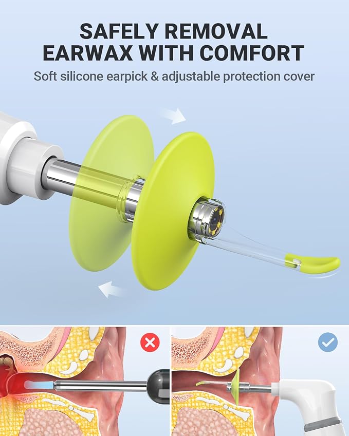 Wireless Otoscope with Gyroscope, Ear Camera with Dual View, 3.9 mm Otoscope with Light, Ear Scope with Ear Wax Removal Tool, Ear Cleaning Kit, Compatible with iPhone and Android