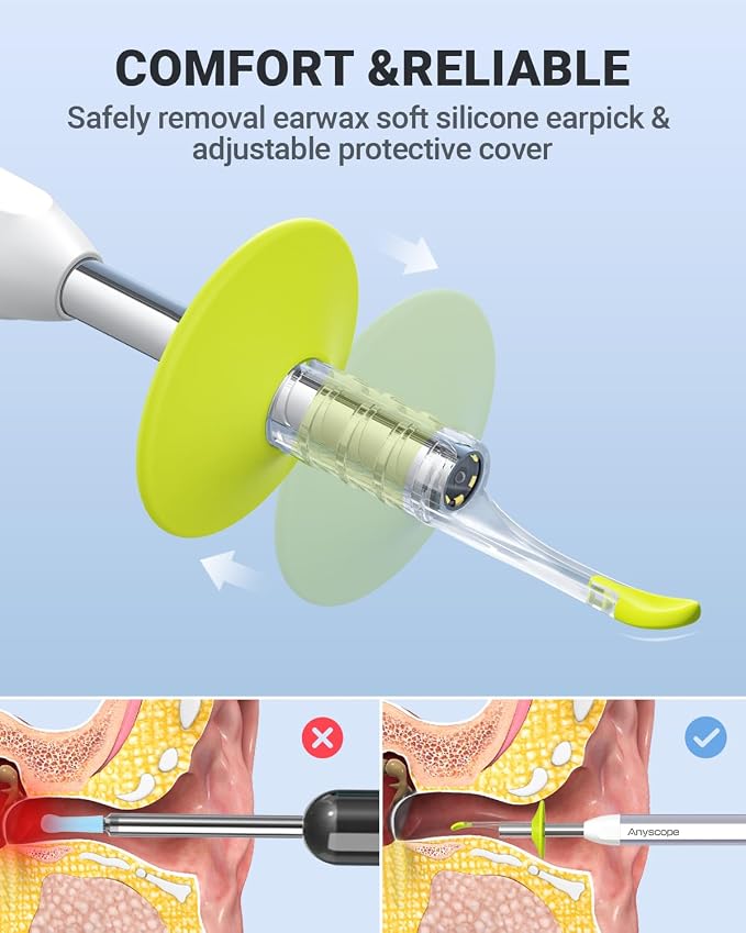 Digital Otoscope with Gyroscope, HD Ear Camera with Ear Wax Removal Tools, Video Ear Scope Otoscope with Light, Compatible with iPhone and Android (White)