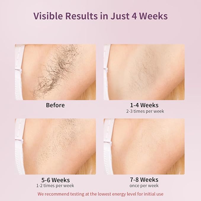 MLAY IPL Laser Hair Removal, Hair Removal Device with Ice Cooling Painless Hair Removal for Women & Men, Permanent Hair Removal at Home for Arms Armpits Face Legs Bikini Line, 5 Energy Levels, 2 Heads
