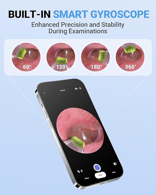 ScopeAround Otoscope with Light, Otoscope Camera w/Dual View, 720pHD WiFi Ear Scope w/ 6 LED Lights, Ear Camera 3.9mm Lens for Kids & Adults, Ear Scope Compatible w/Android & iPhone