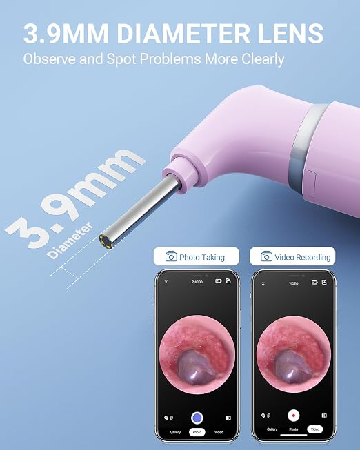 ScopeAround Otoscope with Light, Ear Camera with Dual View, 720pHD WiFi Ear Scope with 6 LED Lights, 3.9mm Lens Otoscope Camera for Kids and Adults, Ear Scope Compatible w/iPhone and Android Pink