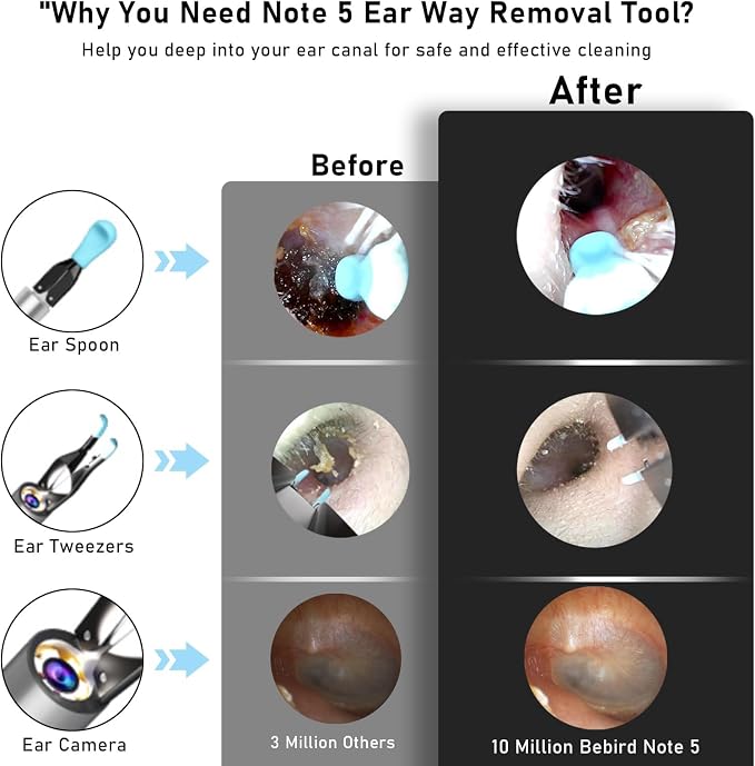 Note5 Ear Wax Removal Kit with Camera,10MP Ear Cleaner Camera Otoscope with Light,Real-time Remote Video with Ear Pick & Tweezers,12 Pcs Ear Scoops for Whole Family